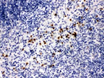 Anti-MMP8 antibody used in IHC (Paraffin sections) (IHC-P). GTX03673