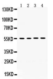 Anti-MMP8 antibody used in Western Blot (WB). GTX03673