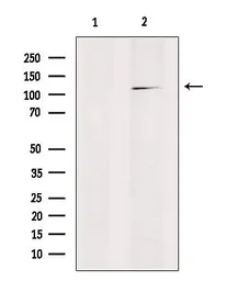 Anti-RanBP17 antibody used in Western Blot (WB). GTX03675