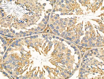 Anti-NEGR1 antibody used in IHC (Paraffin sections) (IHC-P). GTX03680