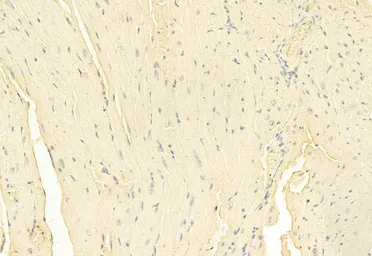 Anti-RIP (phospho Tyr384) antibody used in IHC (Paraffin sections) (IHC-P). GTX03682