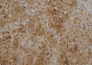 Anti-RIP (phospho Tyr384) antibody used in IHC (Paraffin sections) (IHC-P). GTX03682