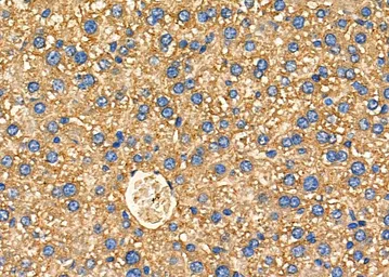 Anti-ARRDC1 antibody used in IHC (Paraffin sections) (IHC-P). GTX03690