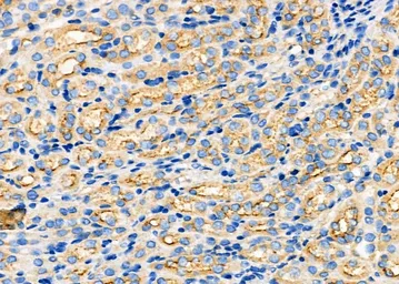 Anti-ARRDC1 antibody used in IHC (Paraffin sections) (IHC-P). GTX03690