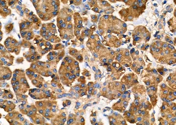 Anti-ARRDC1 antibody used in IHC (Paraffin sections) (IHC-P). GTX03690