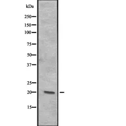 Anti-ITGB3BP antibody used in Western Blot (WB). GTX03692