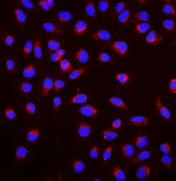 Anti-SGK1 antibody used in Immunocytochemistry/ Immunofluorescence (ICC/IF). GTX03696
