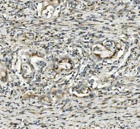 Anti-SGK1 antibody used in IHC (Paraffin sections) (IHC-P). GTX03696