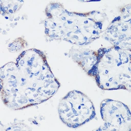 Anti-Kiss1 antibody used in IHC (Paraffin sections) (IHC-P). GTX03697