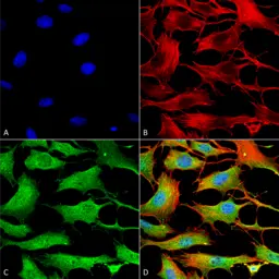 Anti-ATP7b antibody [S62-29] used in Immunocytochemistry/ Immunofluorescence (ICC/IF). GTX03698