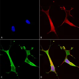 Anti-ATP7b antibody [S62-29] used in Immunocytochemistry/ Immunofluorescence (ICC/IF). GTX03698