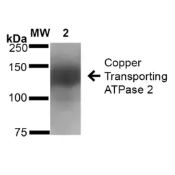 Anti-ATP7b antibody [S62-29] used in Western Blot (WB). GTX03698