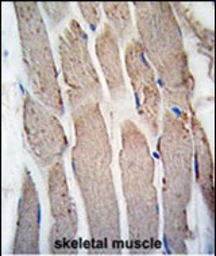 Anti-Gremlin 1 antibody used in IHC (Paraffin sections) (IHC-P). GTX03707