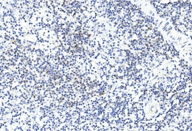 Anti-Gremlin 1 antibody used in IHC (Paraffin sections) (IHC-P). GTX03707