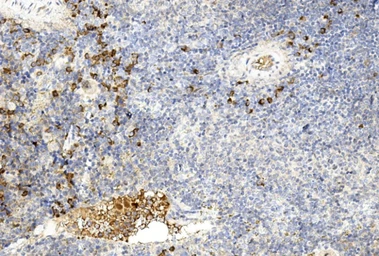 Anti-Gremlin 1 antibody used in IHC (Paraffin sections) (IHC-P). GTX03707