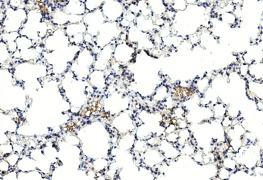 Anti-Gremlin 1 antibody used in IHC (Paraffin sections) (IHC-P). GTX03707