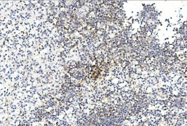 Anti-Gremlin 1 antibody used in IHC (Paraffin sections) (IHC-P). GTX03707