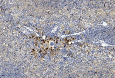 Anti-Gremlin 1 antibody used in IHC (Paraffin sections) (IHC-P). GTX03707