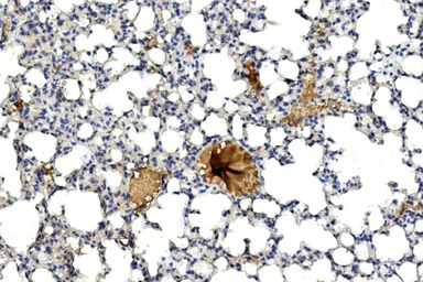 Anti-Gremlin 1 antibody used in IHC (Paraffin sections) (IHC-P). GTX03707