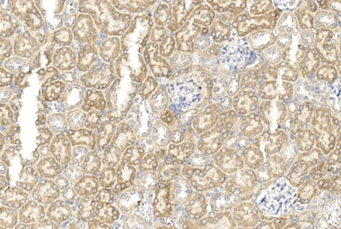 Anti-Gremlin 1 antibody used in IHC (Paraffin sections) (IHC-P). GTX03707