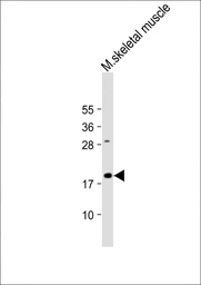 Anti-Gremlin 1 antibody used in Western Blot (WB). GTX03707