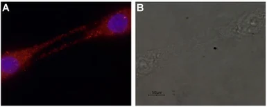 Anti-GDNF antibody used in Immunocytochemistry/ Immunofluorescence (ICC/IF). GTX03708