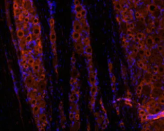 Anti-GDNF antibody used in IHC (Frozen sections) (IHC-Fr). GTX03708
