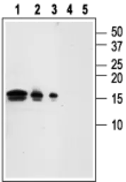 Anti-GDNF antibody used in Western Blot (WB). GTX03708