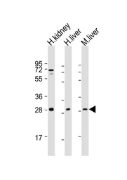 Anti-SIRT3 antibody used in Western Blot (WB). GTX03711