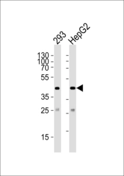 Anti-SIRT3 antibody used in Western Blot (WB). GTX03711