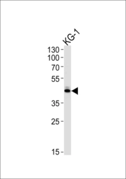 Anti-SIRT3 antibody used in Western Blot (WB). GTX03711