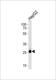 Anti-SIRT3 antibody used in Western Blot (WB). GTX03711