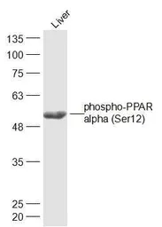 Anti-PPAR alpha (phospho Ser12) antibody used in Western Blot (WB). GTX03713