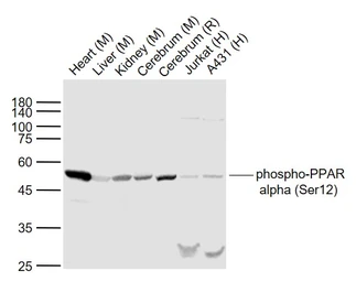 Anti-PPAR alpha (phospho Ser12) antibody used in Western Blot (WB). GTX03713