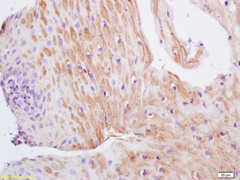 Anti-TIMP1 antibody used in IHC (Paraffin sections) (IHC-P). GTX03714