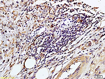 Anti-TIMP1 antibody used in IHC (Paraffin sections) (IHC-P). GTX03714