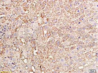 Anti-TIMP1 antibody used in IHC (Paraffin sections) (IHC-P). GTX03714