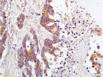 Anti-TIMP1 antibody used in IHC (Paraffin sections) (IHC-P). GTX03714