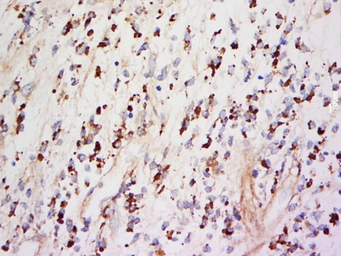 Anti-TIMP1 antibody used in IHC (Paraffin sections) (IHC-P). GTX03714