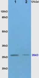 Anti-TIMP1 antibody used in Western Blot (WB). GTX03714