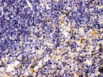 Anti-MMP11 antibody used in IHC (Paraffin sections) (IHC-P). GTX03717