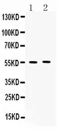 Anti-MMP11 antibody used in Western Blot (WB). GTX03717