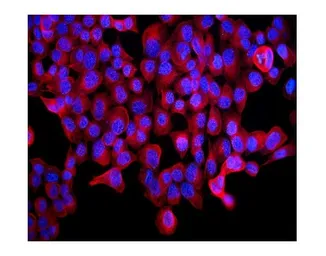 Anti-ABCB5 antibody used in Immunocytochemistry/ Immunofluorescence (ICC/IF). GTX03718