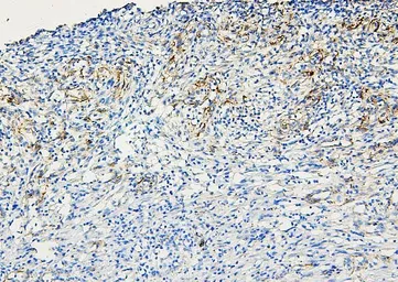Anti-ABCB5 antibody used in IHC (Paraffin sections) (IHC-P). GTX03718