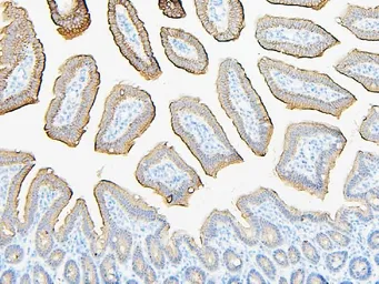 Anti-ABCB5 antibody used in IHC (Paraffin sections) (IHC-P). GTX03718