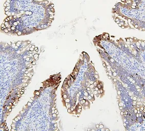 Anti-ABCB5 antibody used in IHC (Paraffin sections) (IHC-P). GTX03718