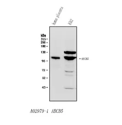 Anti-ABCB5 antibody used in Western Blot (WB). GTX03718