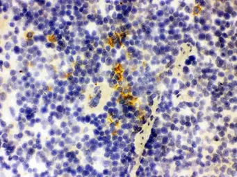 Anti-Lipocalin-2 antibody used in IHC (Frozen sections) (IHC-Fr). GTX03729