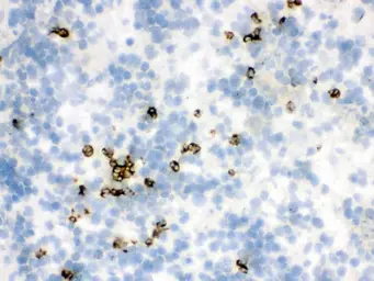 Anti-Lipocalin-2 antibody used in IHC (Frozen sections) (IHC-Fr). GTX03729