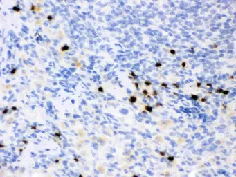 Anti-Lipocalin-2 antibody used in IHC (Paraffin sections) (IHC-P). GTX03729